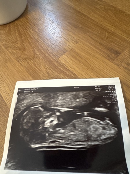 Nub theory guesses on my little baby 🤍