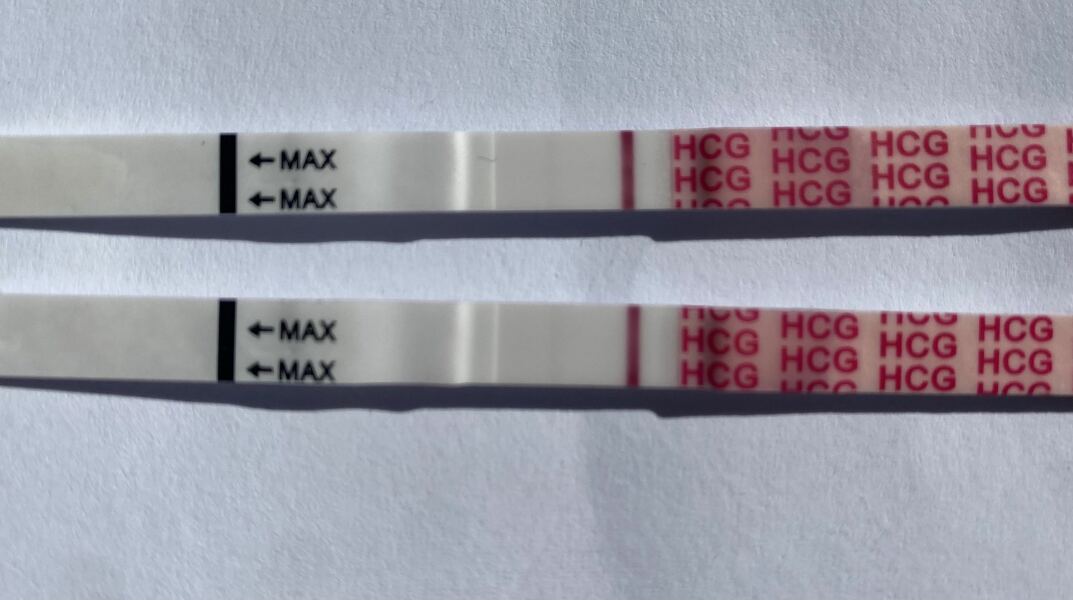 Previous pregnancy HCG or new pregnancy following miscarriage