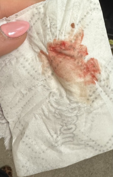 Implantation bleeding?