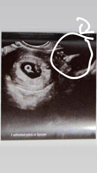 Possibly twins?
