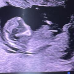 Gender prediction/nub theories please!