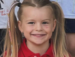 Haemangioma/propranolol