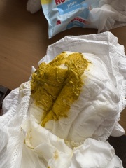 Does this look ‘normal’