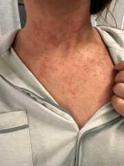 Help Please. Allergic Reaction!