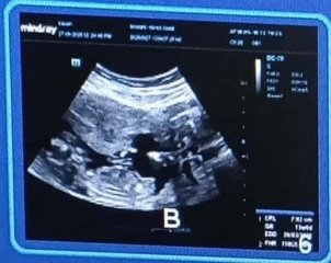 Can find the gender please?