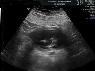 Potty Shot - Definitely a Girl?