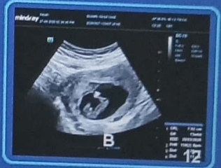 Can find the gender please?