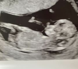 12 week scan gender guess 🙏
