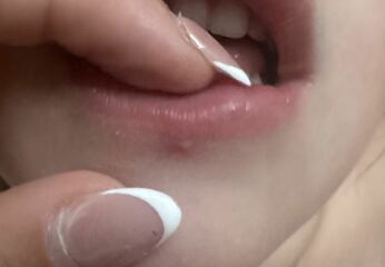 Coldsore or spot? AIBU annoyed at MIL