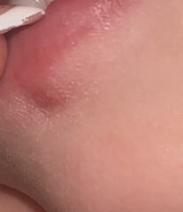 Coldsore or spot? AIBU annoyed at MIL