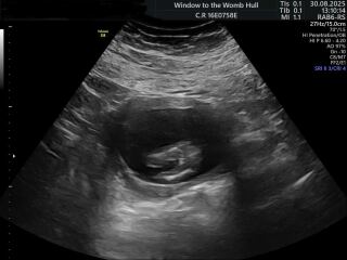 Potty Shot - Definitely a Girl?