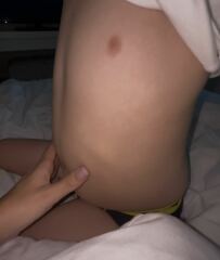 Lump in son’s abdomen?! Panicking