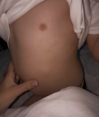 Lump in son’s abdomen?! Panicking