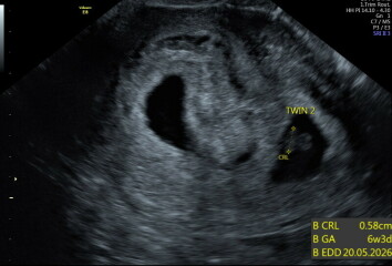 Just found out I’m expecting twins!