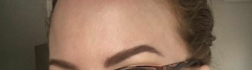 Botox & frozen faces