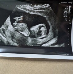Any gender guesses please!! 🩷💙