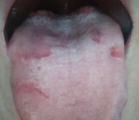 What could be causing my constant raspy throat and soreness?