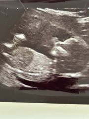 Boy or girl