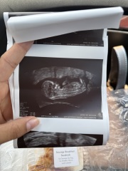 Boy or girl? 12 week scan!