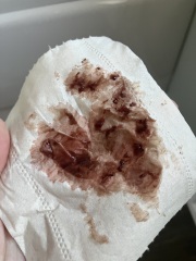 TW:possible miscarriage?