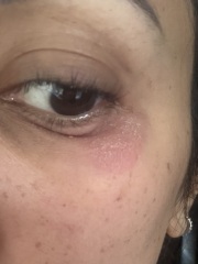 Anyone reacted to Marine Collagen?