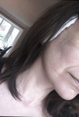 WTF is going on with my face?