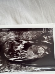 Nub theory guesses on my little baby 🤍