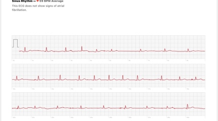 Calling NHS111 ? Or A&E ? Or wait it out ?