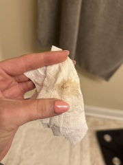 Implantation bleeding?