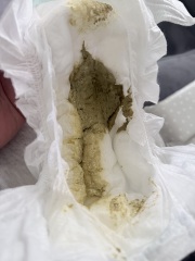 Puramino poo- is this normal?