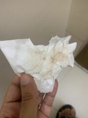 Is this implantation bleeding?