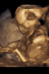3D ultrasound guesses