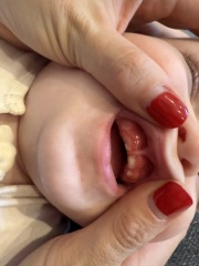 Teething question!