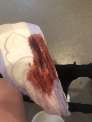 lochia/post partum bleeding helppp