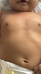 Help??? Aptamil pepti 1 made baby worse