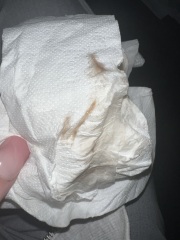 Discharge/bleeding between periods - please help!