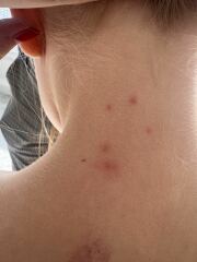 What are these marks on my daughter?