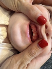 Teething question!