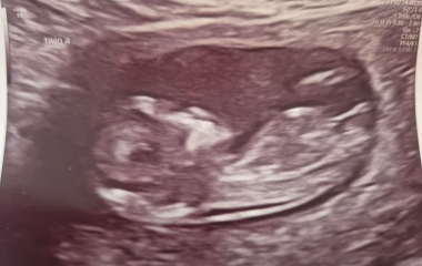 12+4 with twins - nub theory, just for fun!