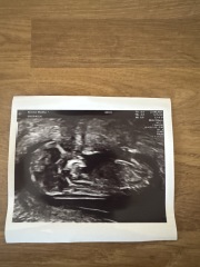 Nub theory guesses on my little baby 🤍