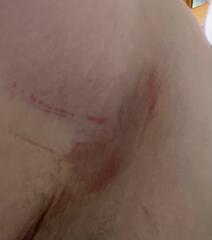 Message from Mitchum regarding skin issues