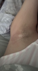 Message from Mitchum regarding skin issues