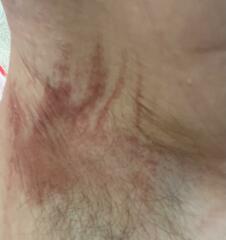 Message from Mitchum regarding skin issues