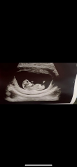 Gender guesses??