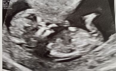 12 week scan gender guess 🙏