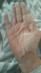 Shamelessly posting for traffic. Medical question and im definitely AIBU for posting disgusting pictures looking for answers