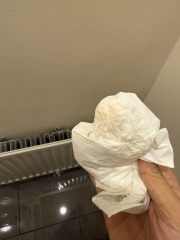 Implantation bleeding or AF. Freaking out!