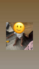 Baby/ 7 month old stiffens legs/arms usually grunts.