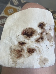 TW:possible miscarriage?