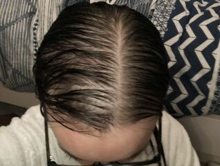 Why is my hair like this?